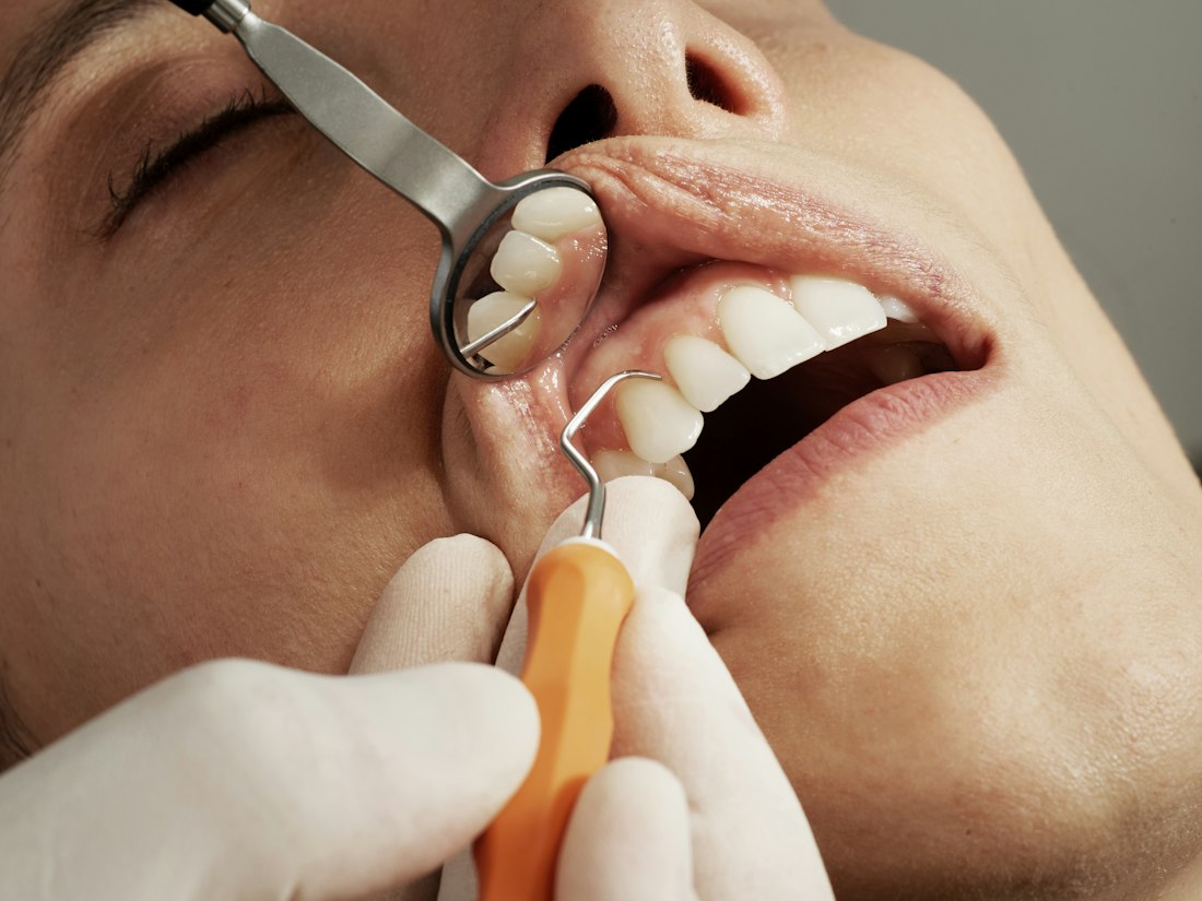 Dental check-up